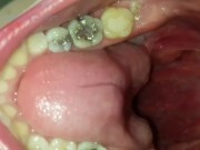 VERY Sexy Redhead's HUGE Mouth POV 7/16