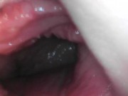 Teen gaping cunt and showing cervix 13/16