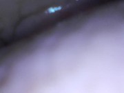 Teen gaping cunt and showing cervix 15/16