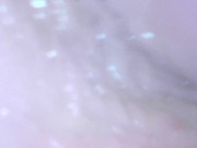 Teen gaping cunt and showing cervix 16/16