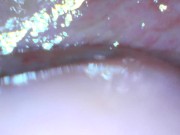 Teen gaping cunt and showing cervix 5/16