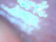 Teen gaping cunt and showing cervix 6/16