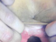 Teen gaping cunt and showing cervix 7/16