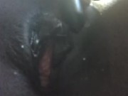 Fun At the Park 16/16