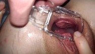Gyno orgasm video Taboo hentai schoolgirl fucked inside a gyno speculum freckledred