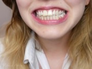 My Mouth Up Close I Guess 5/16