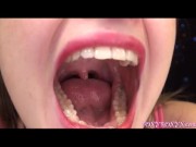 MOUTH OPEN SO WIDE 12/16