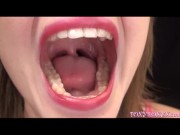 MOUTH OPEN SO WIDE 4/16