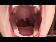 MOUTH OPEN SO WIDE 9/16