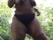 Damn these mosquitoes bites on my ASS! PUBLIC NAKED LITERALLY |§| FluffyB 4/16