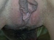 Киска и клитор очень крупным планом, мельчайшие подробности 16/16