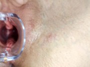 Кончил в мою сводную сестру и провел гинекологическое обследование со спермой внутри оргазма 10/16