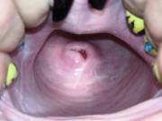 Cervix close up [4k] 11/16