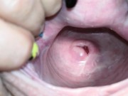 Cervix close up [4k] 13/16
