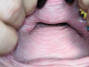 Cervix close up [4k] 14/16