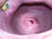 Cervix close up [4k] 16/16