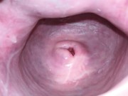 Cervix close up [4k] 8/16