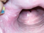 Cervix close up [4k] 9/16