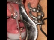 Extreme cervix sounding 10/16