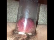 Pumped teen pussy stretched and gaped by big toys and punch fisted hard 1/16