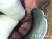 COMPLETE GYNO TEEN EXAM - SPECULUM - ULTRASOUND- URETHRAL -ANAL - PART2 6/16