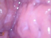 Creampie servix Camera inside Pussy full of Sperm Multiorgasmic girl FULL 13/16