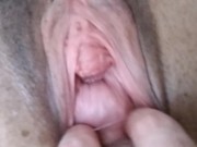 anal fisting training 10/16