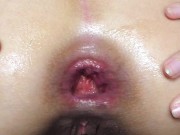 Farting girl, Asshole gaping and prolapsing & Dildo fuck 16/16