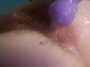 Tiny asshole is stretched with fingers and toys by naughty nurse  1/16