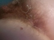 Tiny asshole is stretched with fingers and toys by naughty nurse  13/16