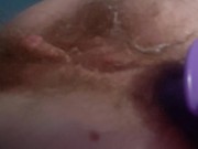 Tiny asshole is stretched with fingers and toys by naughty nurse  9/16