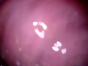 inside my cum filled pussy 2/16