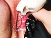 Schamlippen und Kitzler mit Kerze, Clips und Bürste 15/16