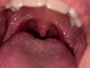 Uvula show. Very close view. Gagging 3/16