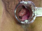 MILF allowing you to get a good look inside pussy. 11/16