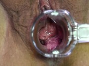 MILF allowing you to get a good look inside pussy. 12/16