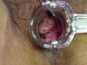 MILF allowing you to get a good look inside pussy. 13/16