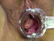 MILF allowing you to get a good look inside pussy. 14/16