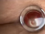 BIG GLASS PLUG IN ASSHOLE 14/16