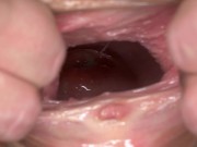 PJGIRLS - Lexi's First Fisting 9/16