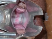 Sri Lanka girl Experiencing Pussy vaginal expansing toy 10/16