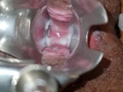 Sri Lanka girl Experiencing Pussy vaginal expansing toy 14/16