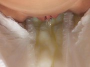 Inside view of a soaked diaper. It Full abdl 6/16