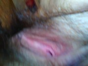 Do you want to see my whole body naked? Crazy Hairy nudist e slut whore cam girl flashes everything 16/16