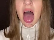 Drooling in glass. Uvula show  10/16