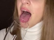 Drooling in glass. Uvula show  11/16