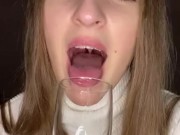 Drooling in glass. Uvula show  4/16