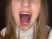 Drooling in glass. Uvula show  5/16