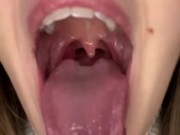 Drooling in glass. Uvula show  7/16