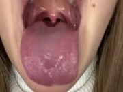 Drooling in glass. Uvula show  8/16